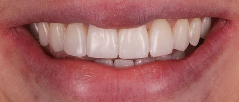 after-smilemakeover-1.jpg