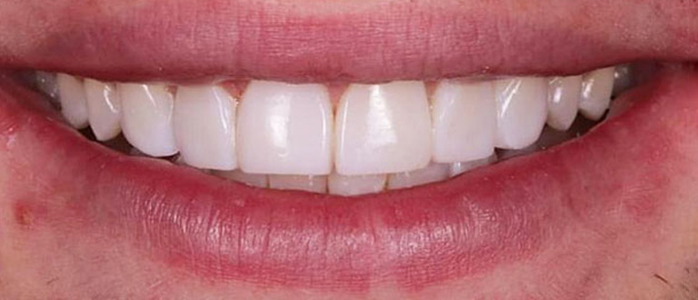 after-smilemakeover-2.jpg