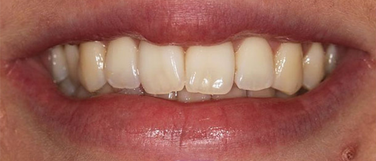 before-smilemakeover-1.jpg