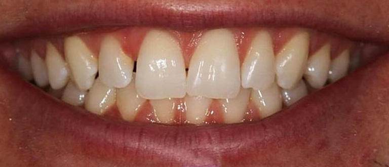 before-smilemakeover-2.jpg