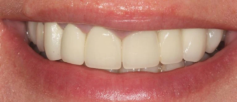 dental smile makeover romford