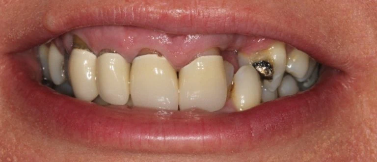 romford dentist smile makeover